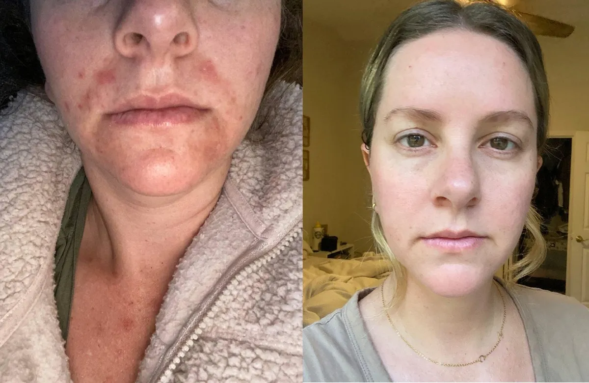 Priscila N. — resultado